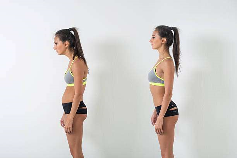How Does Posture Affect Bulging Discs? Tips for Better Spinal Health