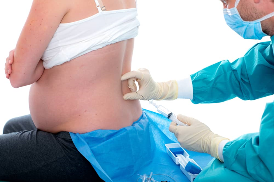 The Science Behind Epidurals: How They Target and Relieve Pain