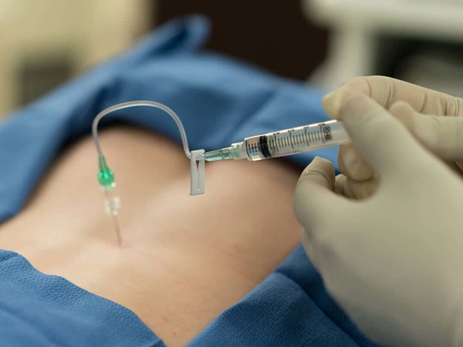 Epidural Steroid Injections: Risks, Side Effects, and Safety Precautions