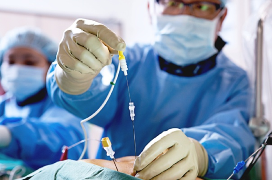 Pain-Free Living: Unlocking the Potential of Radiofrequency Ablation