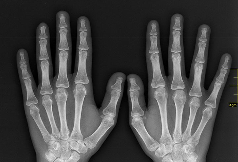 X-Rays vs. MRIs for Pain Diagnosis: Choosing the Right Imaging