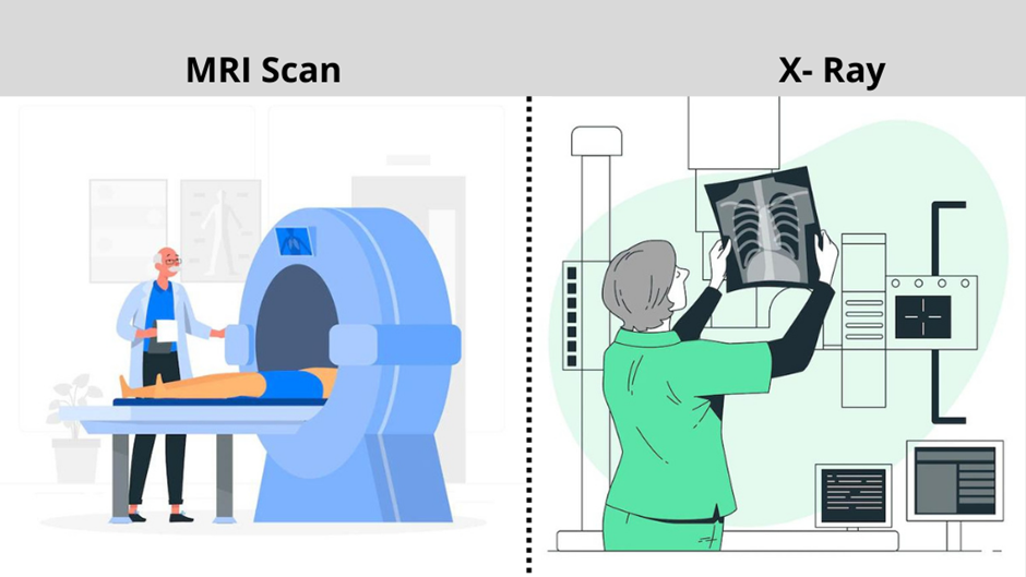 Decoding Diagnostic Imaging: How X-Rays and MRIs Detect Pain Sources