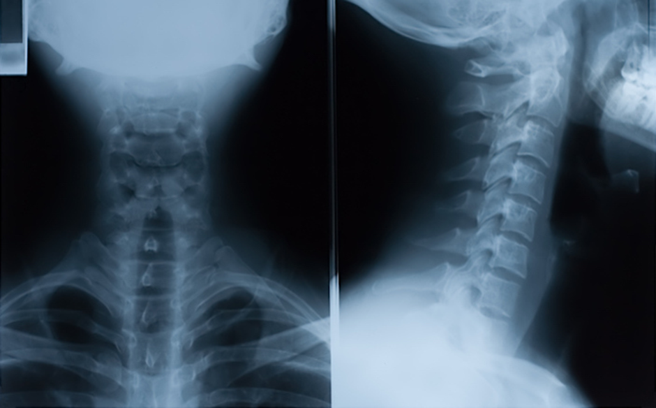 Decoding Diagnostic Imaging: How X-Rays and MRIs Detect Pain Sources