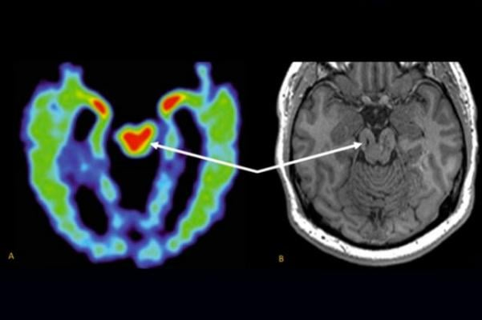 Understanding the Benefits of MRI Scans for Chronic Pain Diagnosis