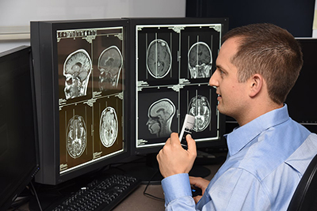 Radiology Insights: How X-Rays and MRIs Impact Pain Treatment Decisions