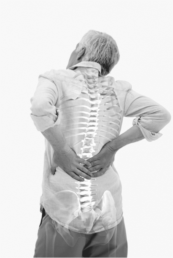 Choosing Vertiflex: Making Informed Decisions About Your Back Pain