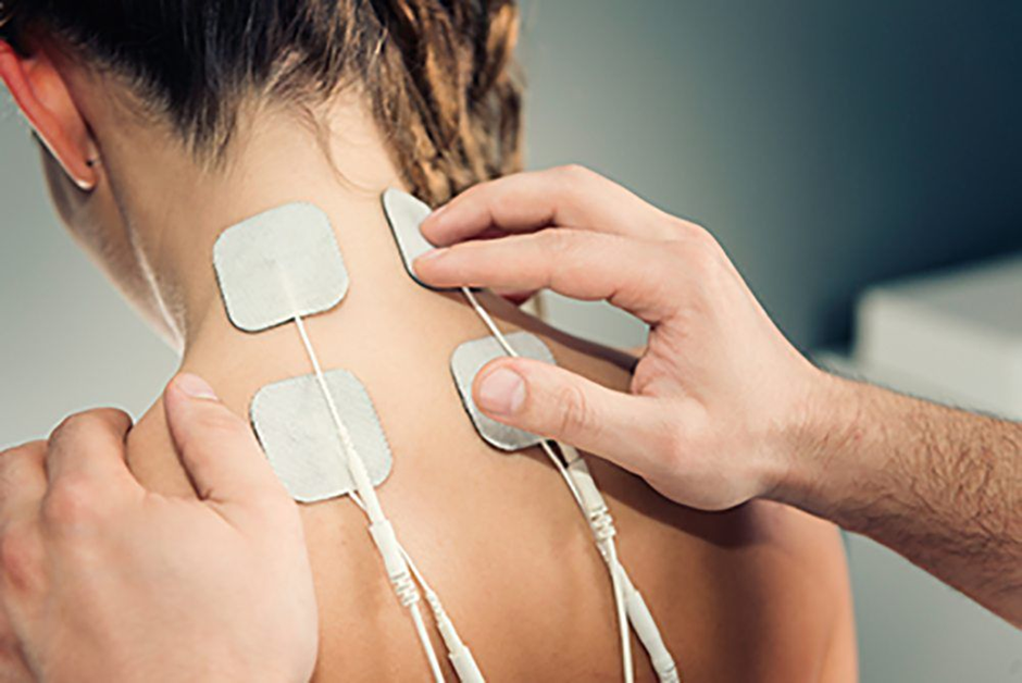 Exploring Peripheral Nerve Stimulation: A Non-Invasive Approach to Pain Relief