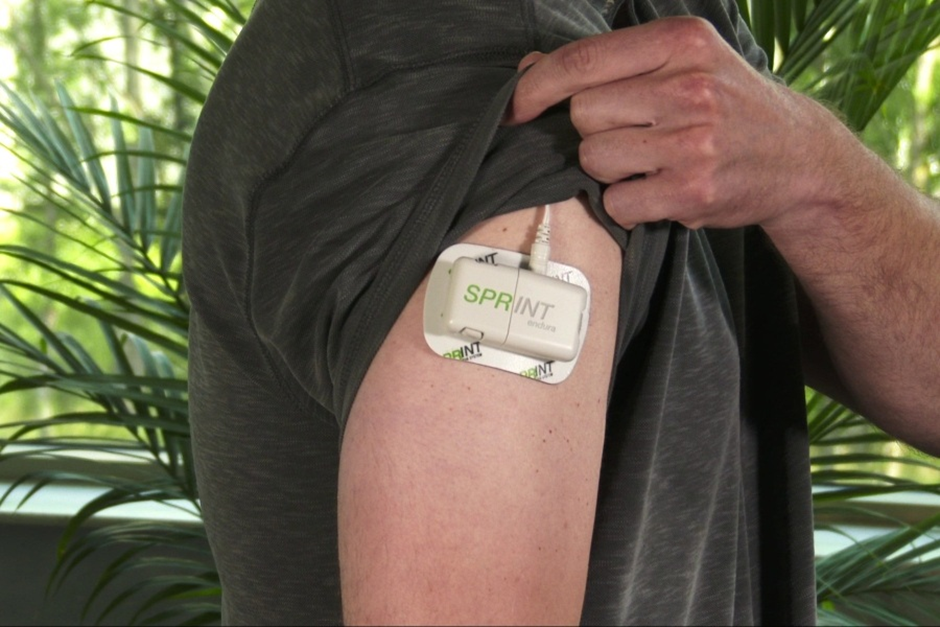 Living Pain-Free with PNS: A Comprehensive Guide to the Procedure
