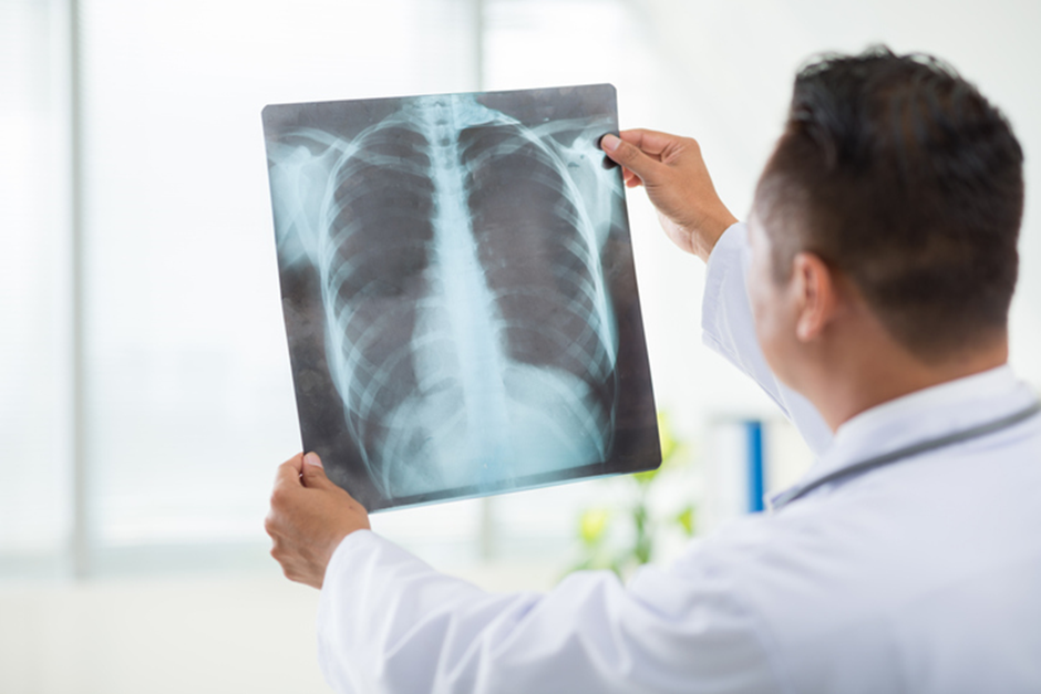 How Do X-rays Help Identify Structural Issues Causing Pain?