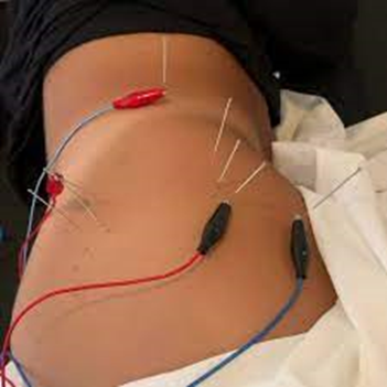 How Does Acupuncture Work to Alleviate Pain?