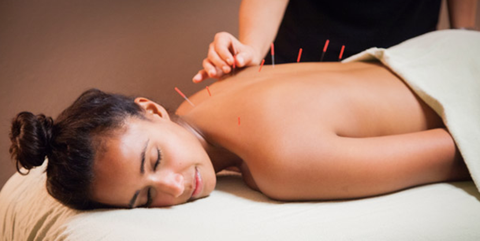 Is Acupuncture a Viable Option for Back Pain Treatment?
