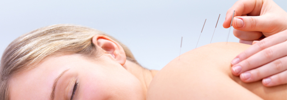 Is Acupuncture a Viable Option for Back Pain Treatment?
