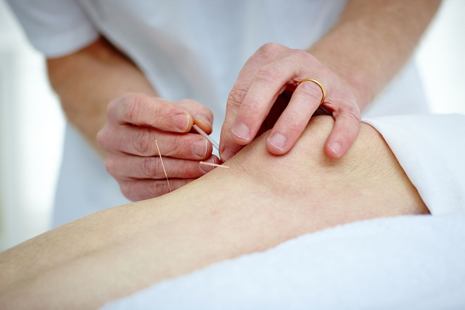 What Types of Pain Conditions Can Acupuncture Address?