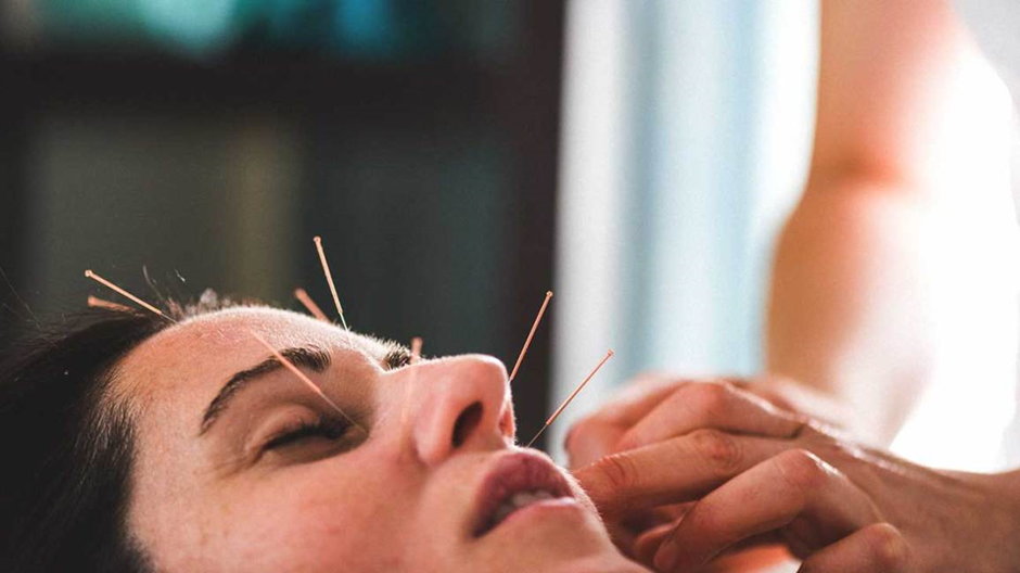 Is Acupuncture Safe for Pain Management?