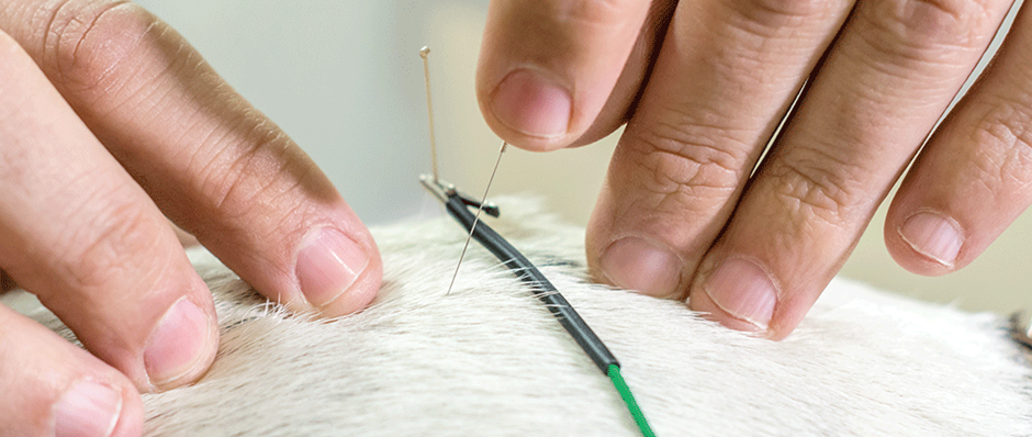 How Many Acupuncture Sessions Are Needed for Pain Relief?