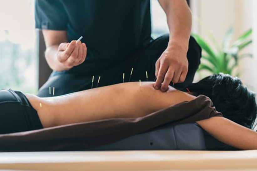 How Many Acupuncture Sessions Are Needed for Pain Relief?