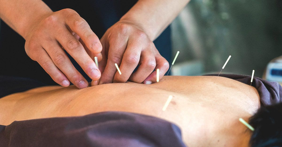What Research Evidence Supports Acupuncture for Pain Relief?